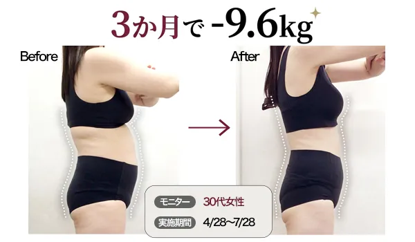 医療痩身のビフォーアフター
